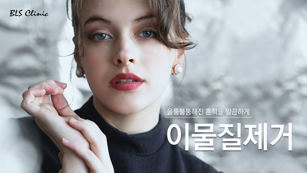 이물질제거